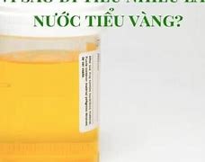 Nước Tiểu Có Mùi Hôi Trứng Thối